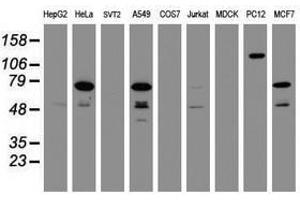 Image no. 2 for anti-Receptor (TNFRSF)-Interacting serine-threonine Kinase 1 (RIPK1) (AA 133-422) antibody (ABIN1490912)