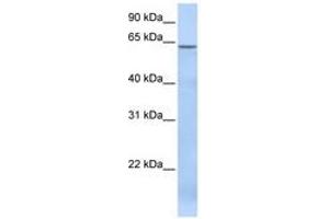 Image no. 1 for anti-TBC1 Domain Family, Member 22A (TBC1D22A) (AA 108-157) antibody (ABIN6741275) (TBC1D22A anticorps  (AA 108-157))