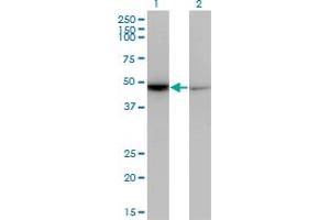 Western Blot analysis of NR0B1 expression in transfected 293T cell line by NR0B1 monoclonal antibody (M07), clone 3G8. (NR0B1 anticorps  (AA 361-470))
