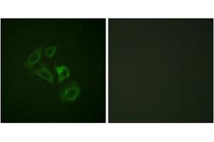 Immunofluorescence analysis of HepG2 cells, using c-Met (Phospho-Tyr1003) antibody. (c-MET anticorps  (pTyr1003))