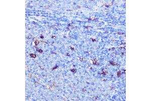 Immunohistochemistry of paraffin-embedded rat spleen using GSDMD Rabbit pAb  at dilution of 1:100 (40x lens). (GSDMD anticorps)