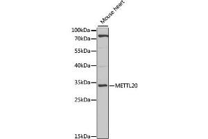 Western blot analysis of extracts of mouse heart, using METTL20 antibody (ABIN2563850) at 1:1000 dilution.