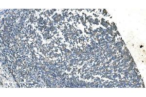 IHC analysis of TIMM8A/DDP using anti-TIMM8A/DDP antibody (ABIN7600039). (TIMM8A/DDP anticorps  (AA 14-97))