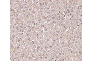 Immunohistochemistry of paraffin-embedded Rat liver using HSF1 Polyclonal Antibody at dilution of 1:100 (40x lens). (HSF1 anticorps)