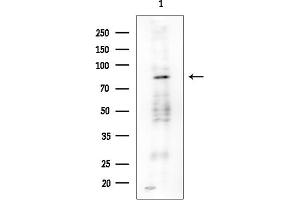 Western blot analysis of lysates from Rat brain, using PNPase Antibody at 1/1000 dilution.