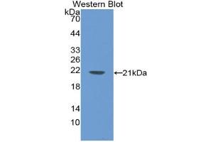 Western blot analysis of the recombinant protein. (LAMB2 anticorps  (AA 75-223))