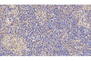 Detection of IL6R in Human Spleen Tissue using Polyclonal Antibody to Interleukin 6 Receptor (IL6R) (IL-6 Receptor anticorps  (AA 216-356))