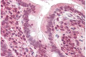 Human Small Intestine (formalin-fixed, paraffin-embedded) stained with POLL antibody ABIN337014 at 5 ug/ml followed by biotinylated anti-goat IgG secondary antibody ABIN481715, alkaline phosphatase-streptavidin and chromogen. (POLL anticorps  (AA 563-575))