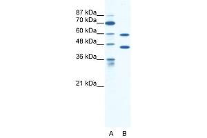 CATSPER2 antibody used at 1. (CATSPER2 anticorps  (C-Term))