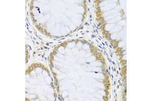 Immunohistochemistry of paraffin-embedded human colon using ARL6 antibody (ABIN5974886) at dilution of 1/100 (40x lens). (ARL6 anticorps)