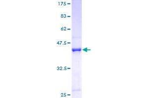 Image no. 1 for Gem (Nuclear Organelle) Associated Protein 6 (GEMIN6) (AA 1-167) protein (GST tag) (ABIN1355000)
