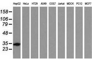 Western blot analysis of extracts (35 µg) from 9 different cell lines by using anti-SULT2A1 monoclonal antibody. (SULT2A1 anticorps)