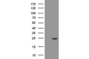 Western Blotting (WB) image for anti-Proteasome (Prosome, Macropain) Subunit, beta Type, 9 (Large Multifunctional Peptidase 2) (PSMB9) (AA 21-219) antibody (ABIN1491191) (PSMB9 anticorps  (AA 21-219))