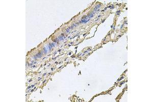 Immunohistochemistry of paraffin-embedded human trachea using FABP12 antibody at dilution of 1:100 (x40 lens).