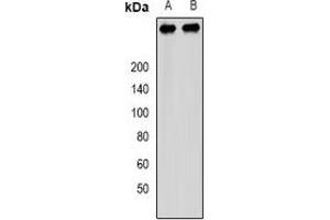 Western blot analysis of PCM1 expression in SW480 (A), 293T (B) whole cell lysates. (PCM1 anticorps)