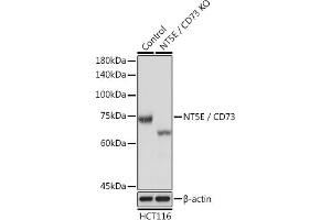 Western blot analysis of extracts from normal (control) and CD73/NT5E Rabbit pAb knockout (KO) HCT116 cells, using CD73/NT5E Rabbit pAb antibody (ABIN3022733, ABIN3022734, ABIN3022735, ABIN1513283 and ABIN6219201) at 1:3000 dilution.