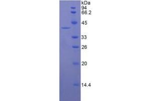 SDS-PAGE of Protein Standard from the Kit (Highly purified E. (KRT16 Kit ELISA)