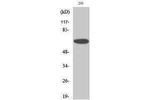 Western Blotting (WB) image for anti-SUMO1 Activating Enzyme Subunit 2 (UBA2) (C-Term) antibody (ABIN3187391) (UBA2 anticorps  (C-Term))