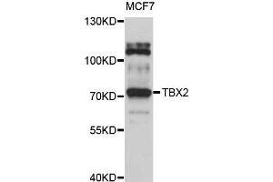 Western blot analysis of extract of MCF7 cells, using TBX2 antibody. (TBX2 anticorps)
