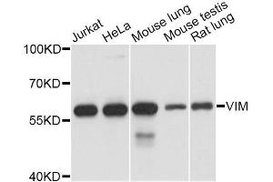 Western blot analysis of extracts of various cell lines, using VIM antibody. (Vimentin anticorps  (AA 1-101))