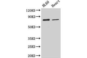 Western Blot Positive WB detected in: HL60 whole cell lysate, Mouse heart tissue All lanes: CAST antibody at 2. (Calpastatin anticorps  (AA 1-667))