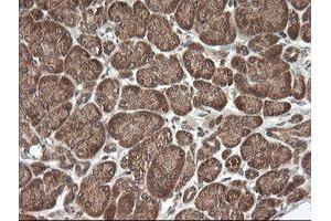 Image no. 5 for anti-Ubiquitin-Conjugating Enzyme E2G 2 (UBE2G2) antibody (ABIN1501634)