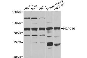 Western blot analysis of extracts of various cell lines, using HDAC10 antibody (ABIN5975007) at 1/1000 dilution. (HDAC10 anticorps)
