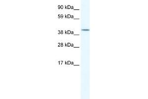 WB Suggested Anti-ISL2 Antibody Titration:  5. (ISL2 anticorps  (C-Term))