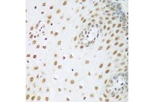 Immunohistochemistry of paraffin-embedded human esophagus using HDAC1 antibody (ABIN5970068) at dilution of 1/100 (40x lens). (HDAC1 anticorps  (N-Term))