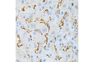 Immunohistochemistry of paraffin-embedded human liver using IQG Rabbit mAb (ABIN7268019) at dilution of 1:100 (40x lens). (IQGAP1 anticorps)