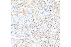 Immunohistochemistry (IHC) image for anti-Fibroblast Activation Protein, alpha (FAP) (AA 26-760) antibody (ABIN7453971)