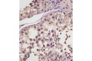 (ABIN6244040 and ABIN6578881) staining MGEA5 in human testis tissue sections by Immunohistochemistry (IHC-P - paraformaldehyde-fixed, paraffin-embedded sections). (MGEA5 anticorps  (AA 236-269))