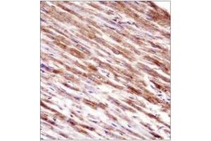 Immunohistochemistry analysis in formalin fixed and paraffin embedded human heart tissue reacted with HSPBP1 Antibody (N-term) followed which was peroxidase conjugated to the secondary antibody and  followed by DAB staining.