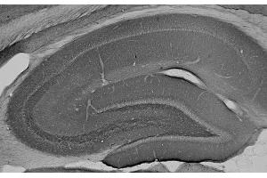 Adult rat hippocampus immunohistochemistry. (ANK2 anticorps  (AA 203-496))