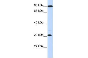 WB Suggested Anti-HOXB8 Antibody Titration:  0. (HOXB8 anticorps  (Middle Region))