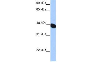 WB Suggested Anti-NEURL2 Antibody Titration: 0. (NEURL2 anticorps  (N-Term))