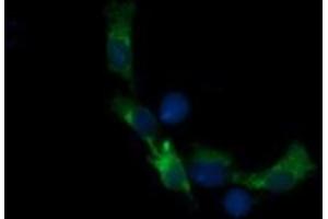 Image no. 3 for anti-Retinoic Acid Receptor Responder (Tazarotene Induced) 1 (RARRES1) antibody (ABIN1500601) (RARRES1 anticorps)