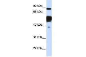 Nexilin antibody used at 1 ug/ml to detect target protein. (NEXN anticorps)
