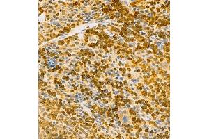 Immunohistochemistry of paraffin embedded mouse spleen using MHC-II (ABIN7074245) at dilution of 1:1800 (400x lens)