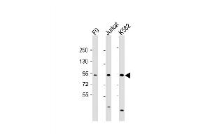 Western Blot at 1:2000 dilution Lane 1: F9 whole cell lysate Lane 2: Jurkat whole cell lysate Lane 3: K562 whole cell lysate Lysates/proteins at 20 ug per lane. (NUP93 anticorps  (AA 20-54))