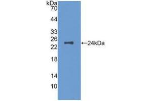 Western blot analysis of recombinant Mouse MCSF. (M-CSF/CSF1 anticorps  (AA 33-204))