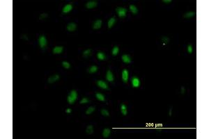 Immunofluorescence of monoclonal antibody to TRIM49 on HeLa cell. (TRIM49 anticorps  (AA 251-340))