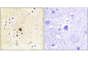 Immunohistochemistry analysis of paraffin-embedded human brain tissue, using RyR2 (Ab-2808) Antibody. (RYR2 anticorps  (AA 2774-2823))