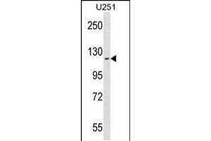 Western blot analysis in U251 cell line lysates (35ug/lane).