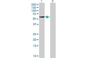 Western Blot analysis of FBXO4 expression in transfected 293T cell line by FBXO4 MaxPab polyclonal antibody. (FBXO4 anticorps  (AA 1-387))