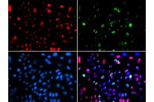 Immunofluorescence (IF) image for anti-Tumor Protein P53 (TP53) (pSer15) antibody (ABIN1870674) (p53 anticorps  (pSer15))