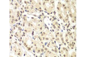Immunohistochemistry of paraffin-embedded Human stomach using ULK4 Polyclonal Antibody at dilution of 1:100 (40x lens).