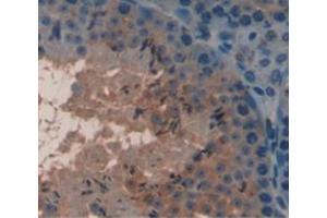 IHC-P analysis of Mouse Tissue, with DAB staining. (COMP anticorps  (AA 317-455))