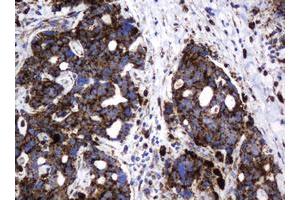 Image no. 2 for anti-Galactosidase, beta 1 (GLB1) antibody (ABIN1498467)