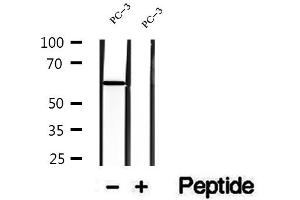 Western blot analysis of extracts of PC-3 cells, using DPP4 antibody. (DPP4 anticorps  (C-Term))